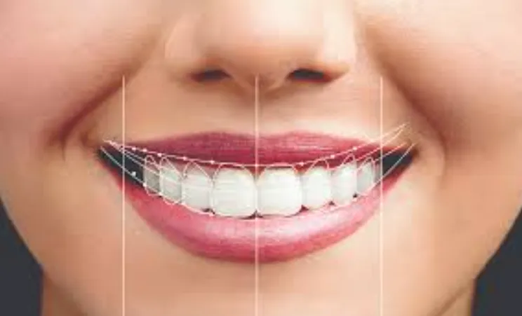 Digital Smile Design: The New Luxury Standard in Tech-Driven Aesthetics Digital Smile Design The New Luxury Standard in Tech-Driven Aesthetics